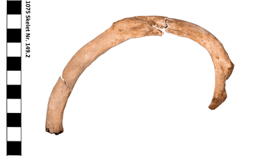 Gebogener Knochen mit Massstab links gezeigt.